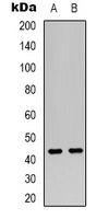 VN1R2 Rabbit Polyclonal Antibody