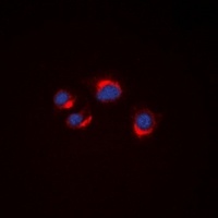 VN1R2 Rabbit Polyclonal Antibody