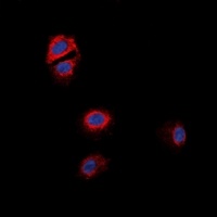 GPR170 Rabbit Polyclonal Antibody