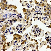 ZAP70 Antibody