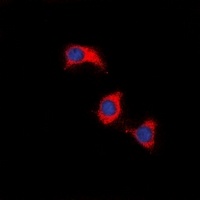 ZAP70 Antibody