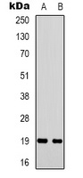 STMN1 Rabbit Polyclonal Antibody