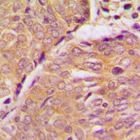 STMN1 Rabbit Polyclonal Antibody