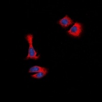 STMN1 Rabbit Polyclonal Antibody