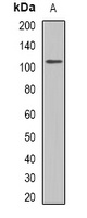 GLUR1 Rabbit Polyclonal Antibody