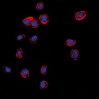 GLUR1 Rabbit Polyclonal Antibody