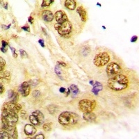 GATA5 Rabbit Polyclonal Antibody