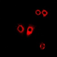 PDI Rabbit Polyclonal Antibody