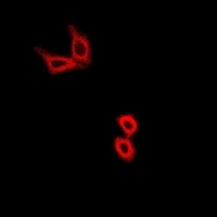 Hexokinase 2 Rabbit Polyclonal Antibody