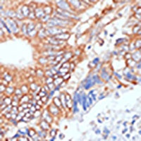Alpha-enolase Antibody