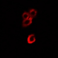 Alpha-enolase Antibody