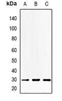 MTAP Rabbit Polyclonal Antibody