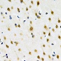 MTAP Rabbit Polyclonal Antibody