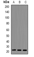 RhoC Rabbit Polyclonal Antibody