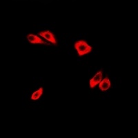 RhoC Rabbit Polyclonal Antibody