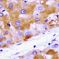 HADH Rabbit Polyclonal Antibody