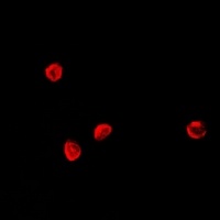 TCF4 Rabbit Polyclonal Antibody