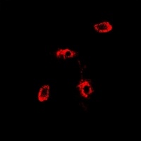 RAB11A Rabbit Polyclonal Antibody