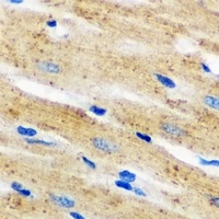 p67 phox Rabbit Polyclonal Antibody