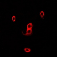 p67 phox Rabbit Polyclonal Antibody