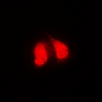 GGA2 Rabbit Polyclonal Antibody
