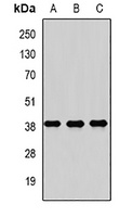 RASSF1 Rabbit Polyclonal Antibody