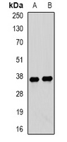 Tropomyosin 3 Rabbit Polyclonal Antibody