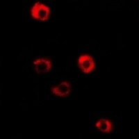 Tropomyosin 3 Rabbit Polyclonal Antibody