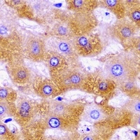SHMT2 Rabbit Polyclonal Antibody