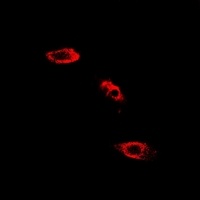 SHMT2 Rabbit Polyclonal Antibody