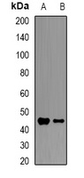 HFE Rabbit Polyclonal Antibody