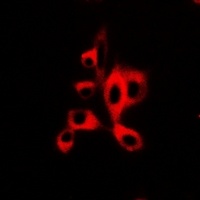 AdipoR1 Rabbit Polyclonal Antibody