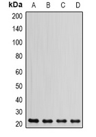 DHFR Rabbit Polyclonal Antibody