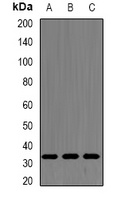 SF2 Rabbit Polyclonal Antibody