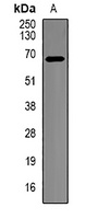 beta-TrCP Rabbit Polyclonal Antibody