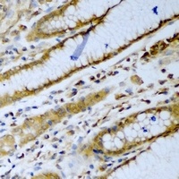 beta-TrCP Rabbit Polyclonal Antibody