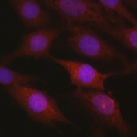 beta-TrCP Rabbit Polyclonal Antibody