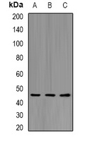 CD158b2 Rabbit Polyclonal Antibody