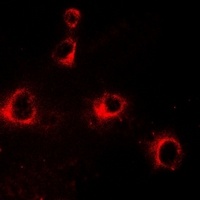 CD158b2 Rabbit Polyclonal Antibody