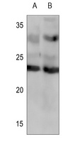 Frataxin Rabbit Polyclonal Antibody