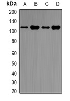 E6AP Rabbit Polyclonal Antibody