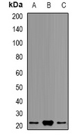 PSMB9 Rabbit Polyclonal Antibody