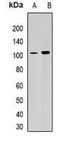 RPGR Rabbit Polyclonal Antibody
