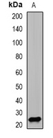PSMD10 Rabbit Polyclonal Antibody