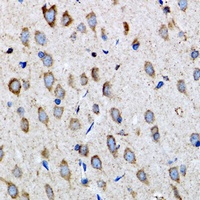 PSMD10 Rabbit Polyclonal Antibody