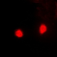 PSMD10 Rabbit Polyclonal Antibody