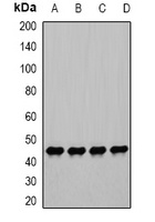 PGK1 Rabbit Polyclonal Antibody