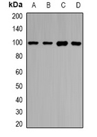 HIWI1 Rabbit Polyclonal Antibody