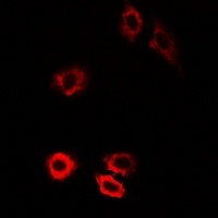 HIWI1 Rabbit Polyclonal Antibody