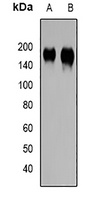 ABCC4 Rabbit Polyclonal Antibody